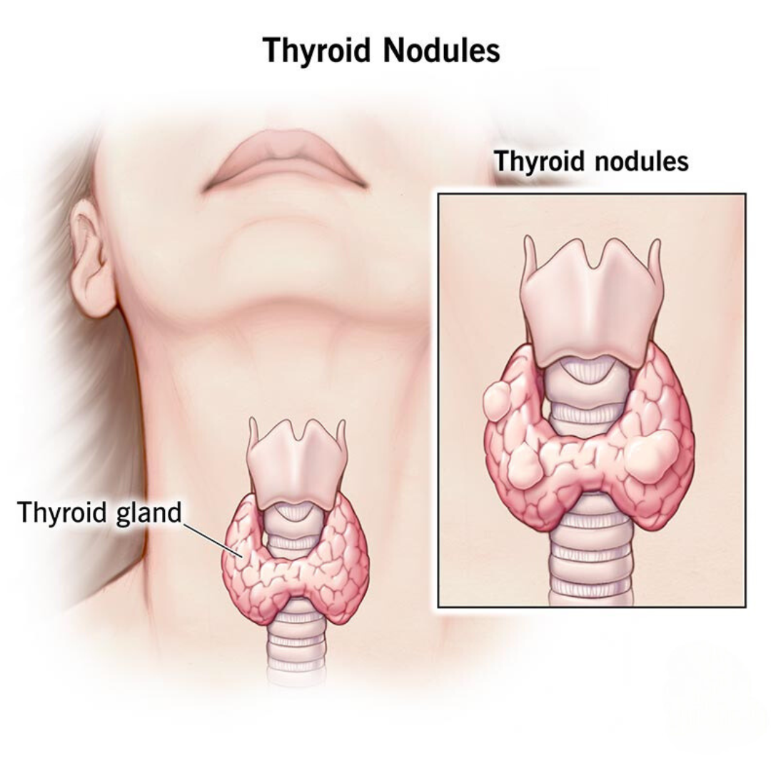 Thyriod-Raja-Hospital-1.png