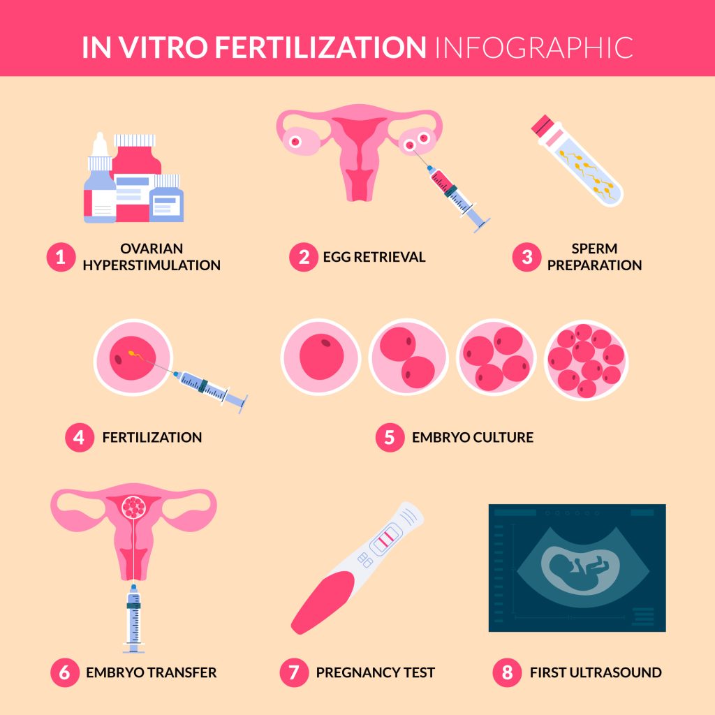 IVF Procedure- Raja Hospital