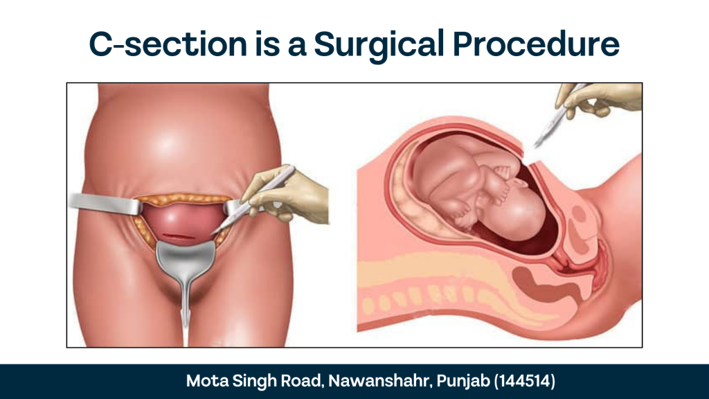 What Happens During a C Section 2