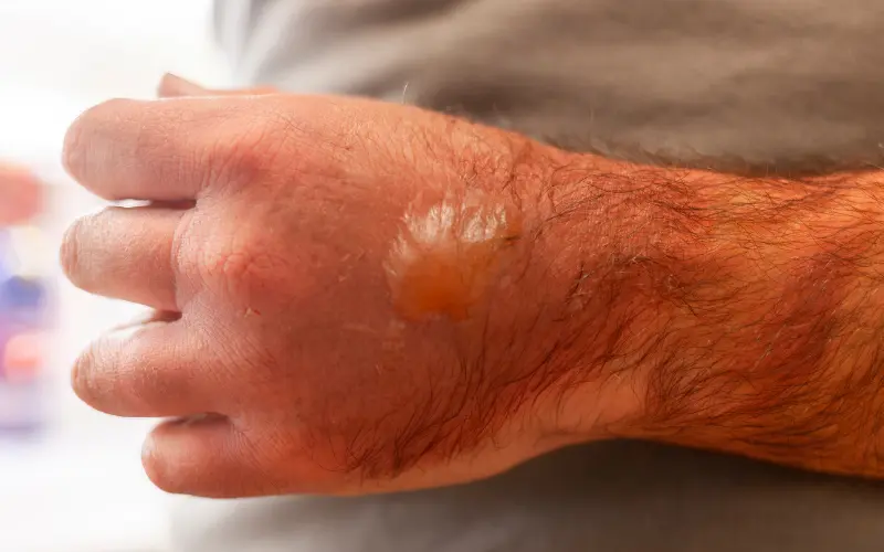 Blog Images 2025 11 12T213157.174 1