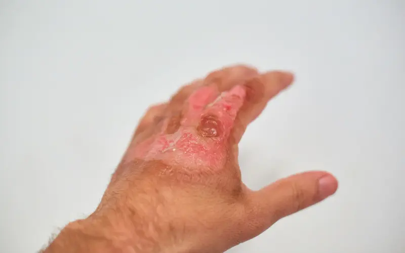 Blog Images 2025 11 12T213339.523 1