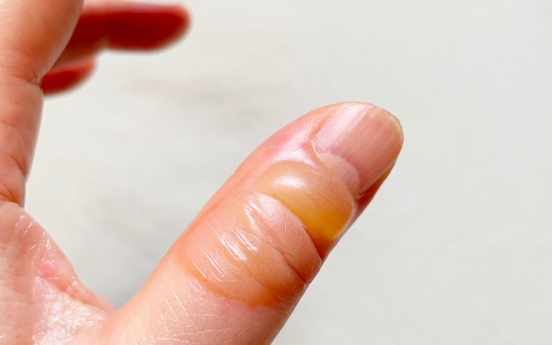 Blog Images 2025 11 13T012421.968 1